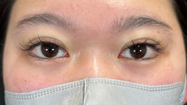 Postoperative Condition Part 1