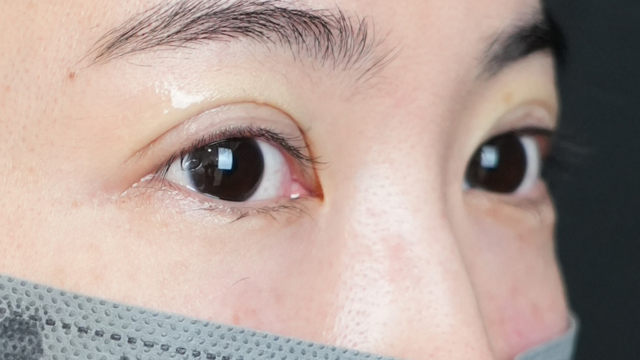 Postoperative Condition Part 1