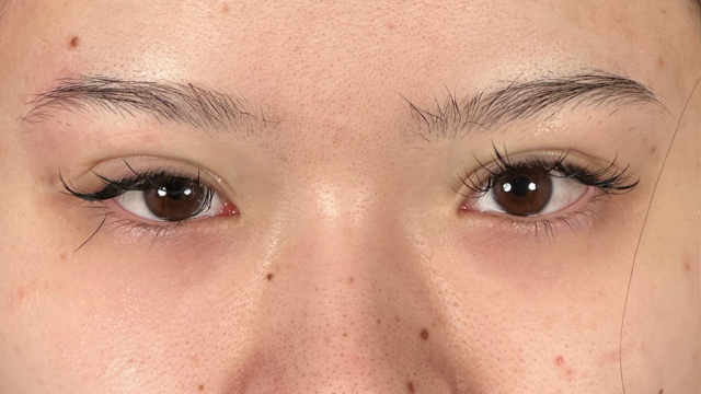 Postoperative Condition Part 1