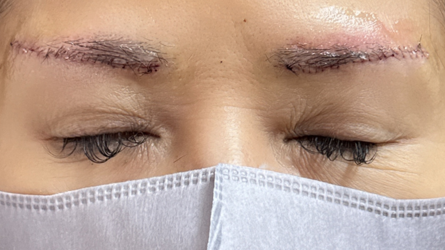 Postoperative Condition Part 1