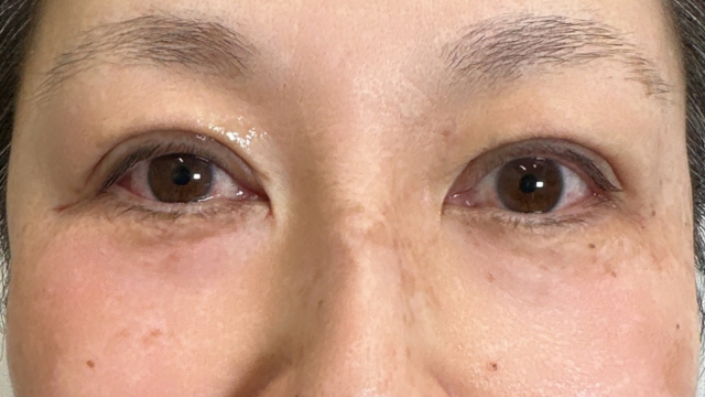 Postoperative Condition Part 1