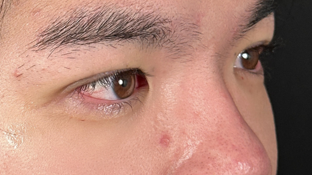 Postoperative Condition Part 1