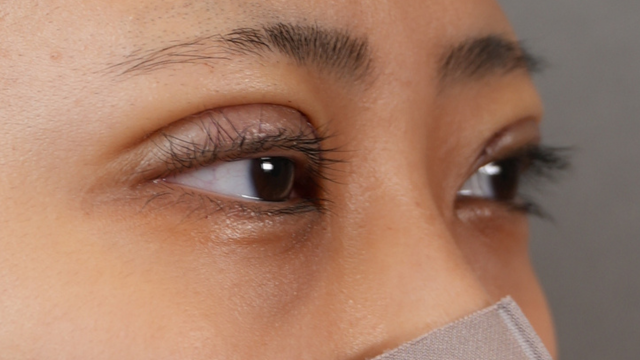 Postoperative Condition Part 1