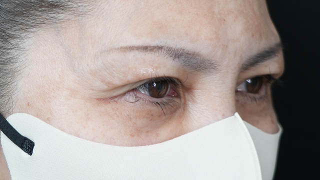 Postoperative Condition Part 1