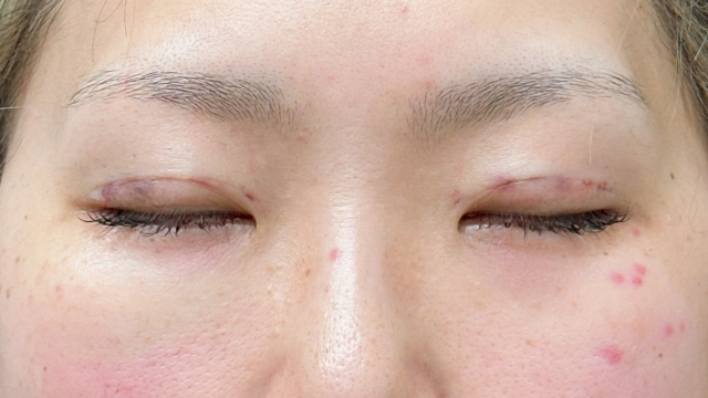 Postoperative Condition Part 1