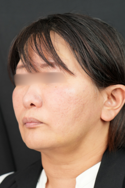 Postoperative Condition Part 1