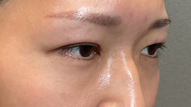 Postoperative Condition Part 1