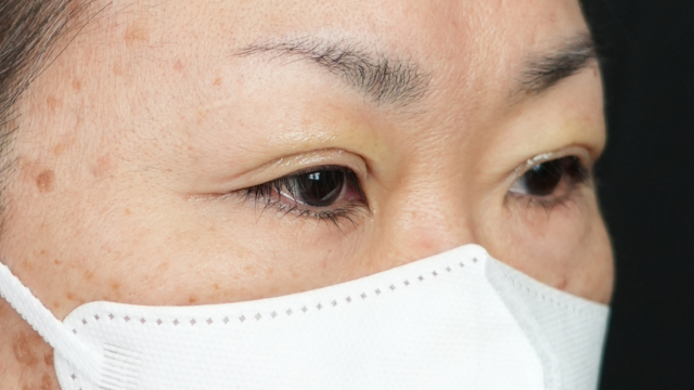 Postoperative Condition Part 1