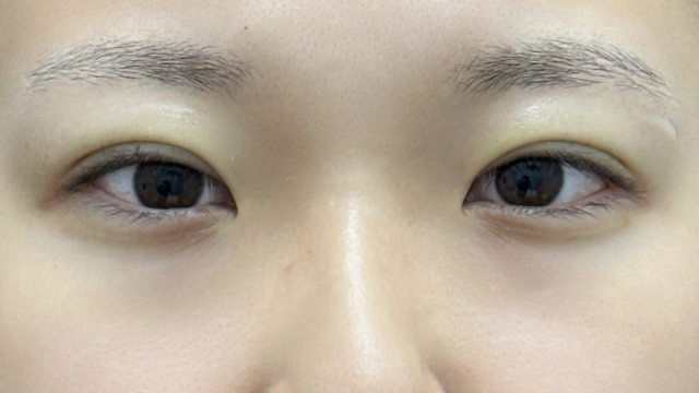 Postoperative Condition Part 1