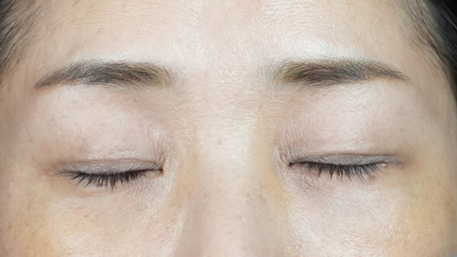 Postoperative Condition Part 1