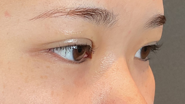 Postoperative Condition Part 1