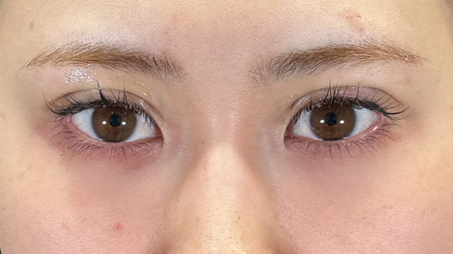 Postoperative Condition Part 1