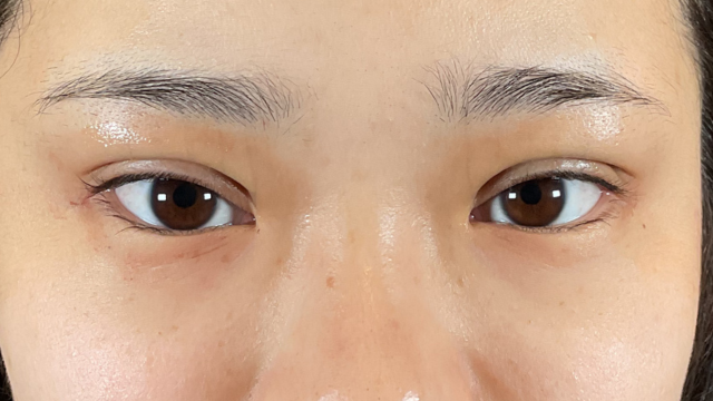 Postoperative Condition Part 1