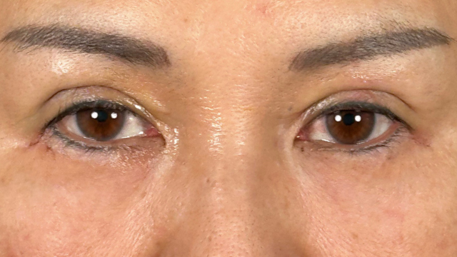 Postoperative Condition Part 1