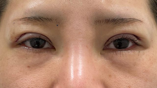 Postoperative Condition Part 1