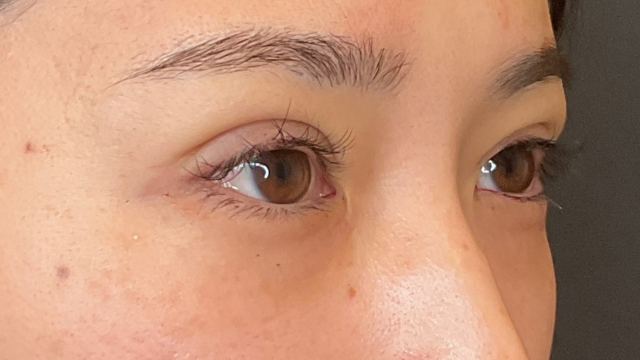 Postoperative Condition Part 1