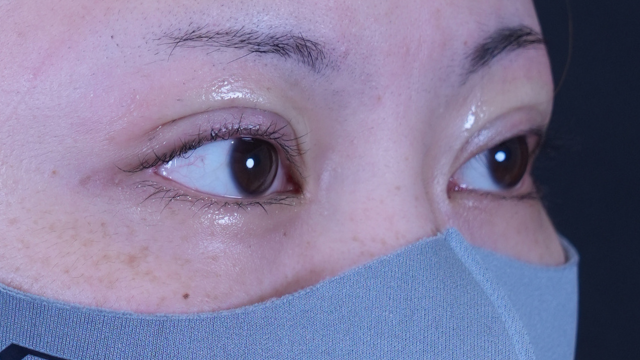 Postoperative Condition Part 1