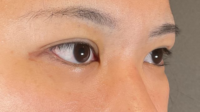 Postoperative Condition Part 1