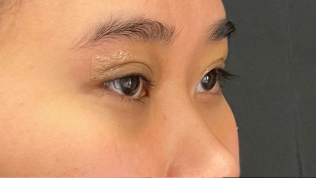 Postoperative Condition Part 1