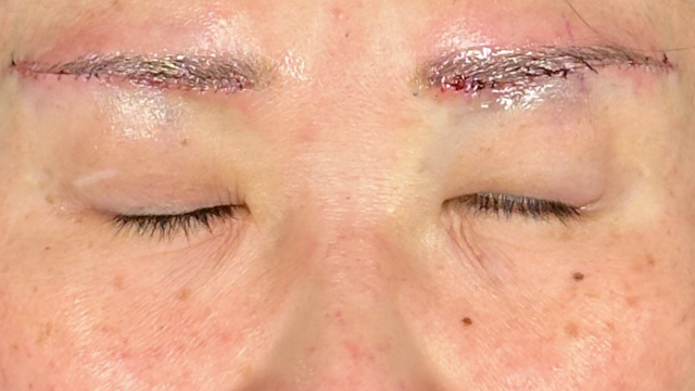 Postoperative Condition Part 1