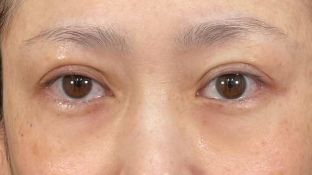 Postoperative Condition Part 1