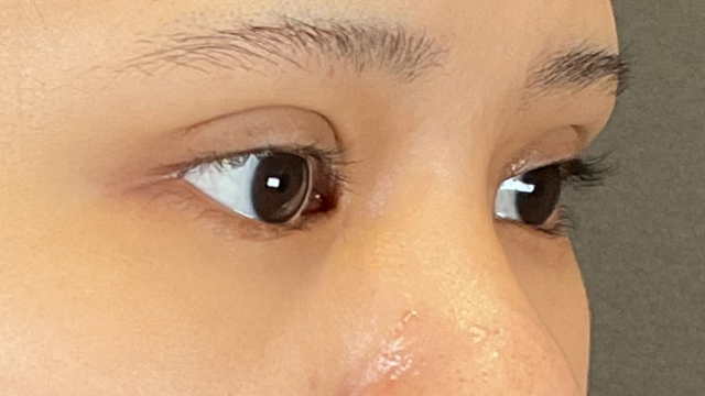 Postoperative Condition Part 1