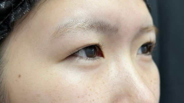 Postoperative Condition Part 1