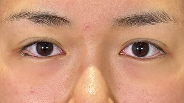 Postoperative Condition Part 1