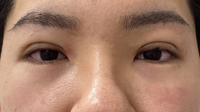 Postoperative Condition Part 1