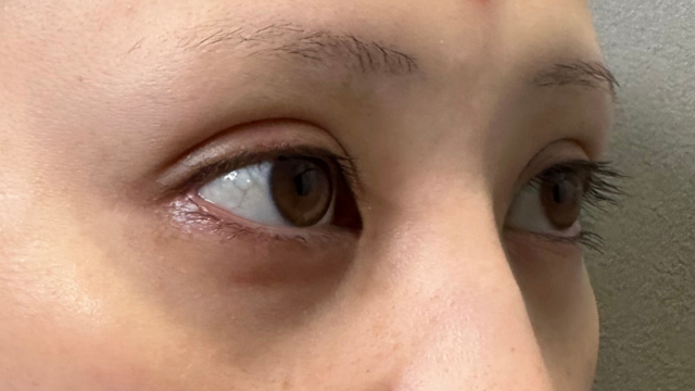 Postoperative Condition Part 1