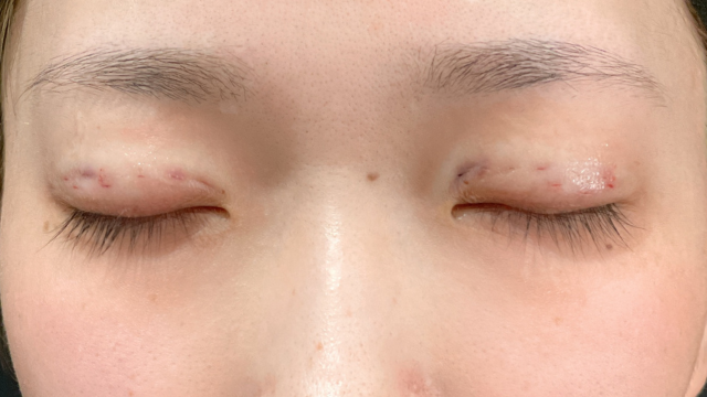 Postoperative Condition Part 1