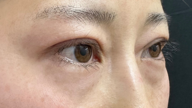 Postoperative Condition Part 1