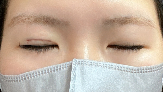 Postoperative Condition Part 1