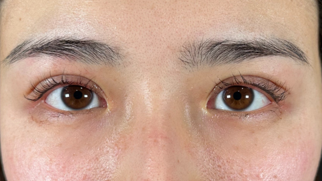 Postoperative Condition Part 1