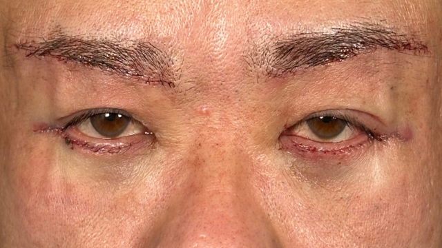 Postoperative Condition Part 1