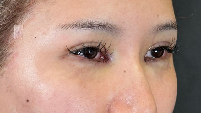 Postoperative Condition Part 1