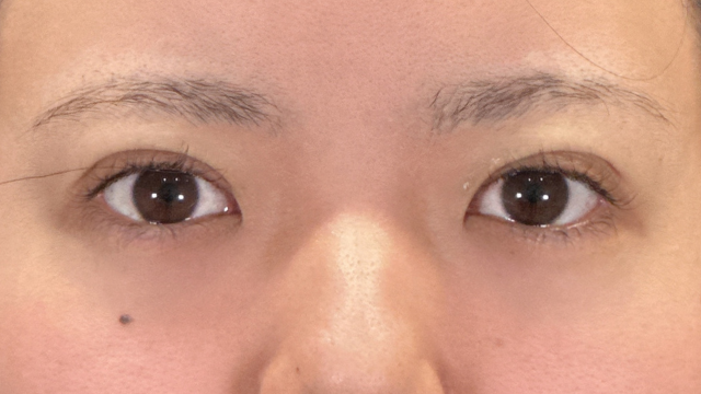 Postoperative Condition Part 1