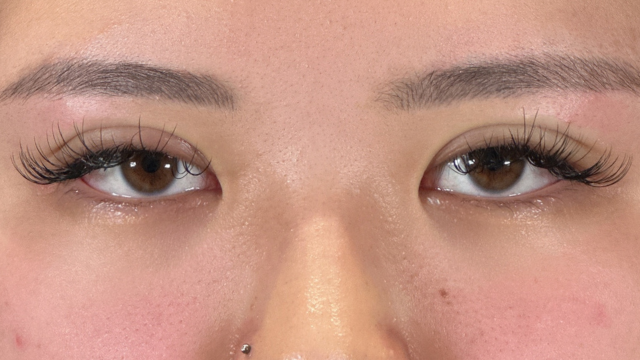 Postoperative Condition Part 1