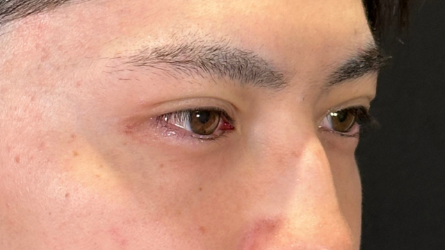 Postoperative Condition Part 1