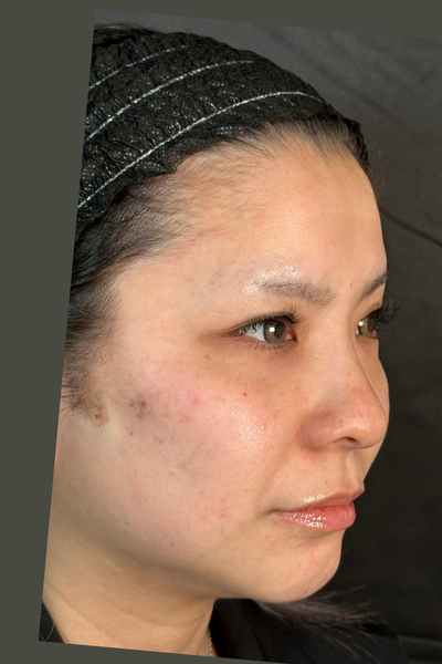 手術前の状態 その1