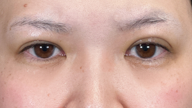 Postoperative Condition Part 1