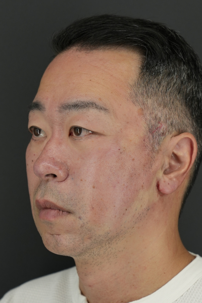 Postoperative Condition Part 1