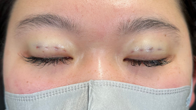 Postoperative Condition Part 1