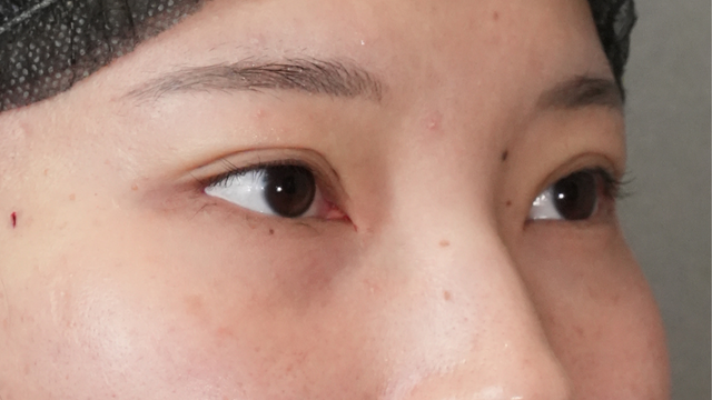 Postoperative Condition Part 1