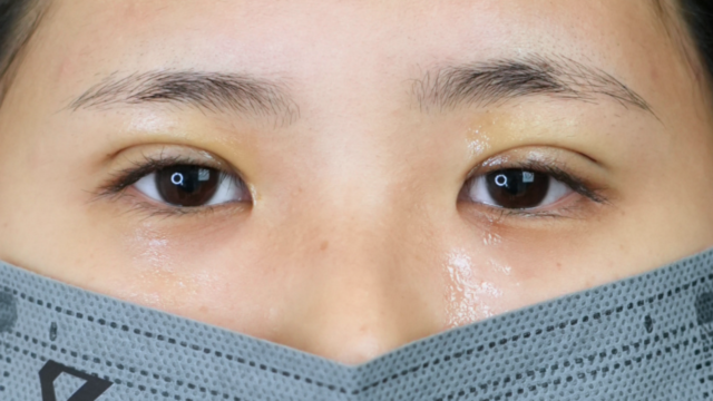 Postoperative Condition Part 1