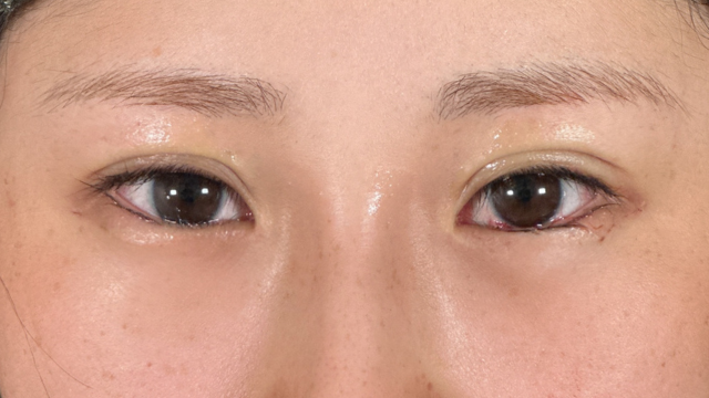 Postoperative Condition Part 1