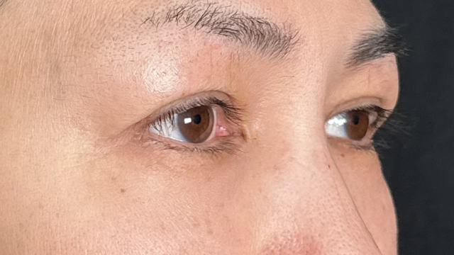 Postoperative Condition Part 1