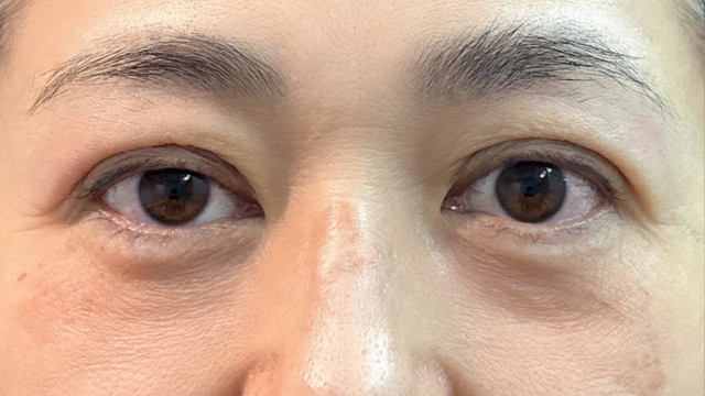 Postoperative Condition Part 1