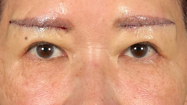 Postoperative Condition Part 1