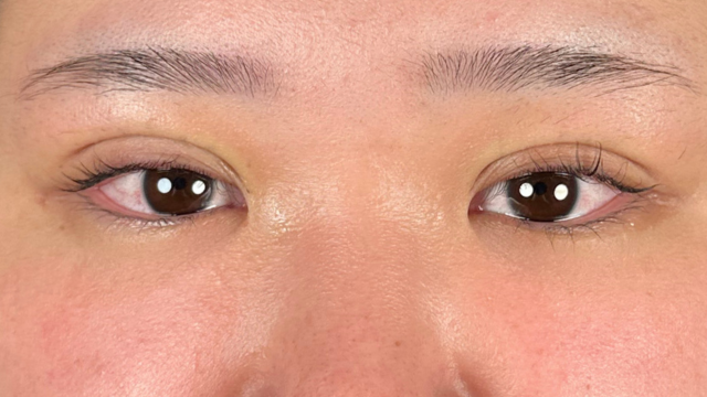 Postoperative Condition Part 1